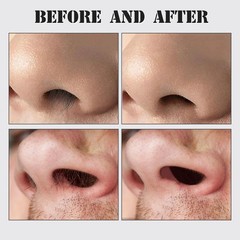 2025 Upgraded Nasal Hair Cutter, 2-in-1 Professional Nostril Hair Remover Tool